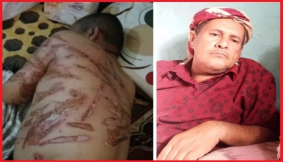 "جريمة وحشية".. وفاة مُسن جراء التعذيب الشديد في سجون الانتقالي الجنوبي بأبين